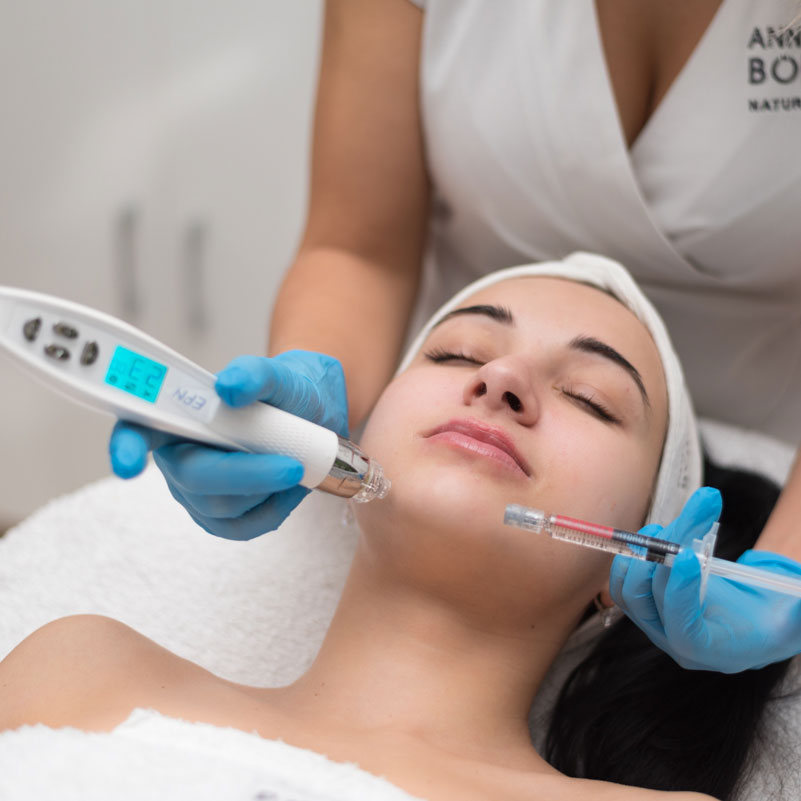 Mezoterapia Použitie: transport účinných látok, redukcia vrások, facelifting, omladenie tváre, vyhladenie jaziev a rán, zúženie pórov, ošetrenie vlasovej pokožky hlavy. Pri klasických mikroihličkových prístrojoch prienik účinných látok naráža na ťažkosti vyplývajúce z obrannej reakcie organizmu, ktorá sa okamžite rozbieha po poraneniach spôsobených ihlou, a sťažuje dodanie účinných látok do hlbších vrstiev. Prístroj EPN spoločnosti EunSung ponúka riešenie tohto problému. Okrem jeho klasického použitia ako mikroihličkového prístroja je výhodou možnosť kombinovať ho s elektroporačnou technológiou, ktorá umožní, aby do pokožky prenikli aj potrebné účinné látky. V elektropačnom režime sa okolo ihly zvyšuje priepustnosť bunkovej membrány, preto účinné látky prenikajú cez bunkové steny aj do hlbších vrstiev kožného tkaniva. Trvanie ošetrenia 60 minút Ideálny efekt sa dosiahne po viacerých opakovaniach (3x), následne udržiavacia terapia raz za pol roka. Po zákroku odporúčame 12 hodín nenanášať mejkap, týždeň po zákroku vynechať pobyt na slnku alebo v soláriu a v saune. Kontraindikácie: Tehotenstvo - kojenie - kožné ochorenie - poruchy zrážanlivosti krvi - akútne prebiehajúce ochorenie - ochorenie ovplyvňujúce funkcie imunitného systému - solárny erytém - známa precitlivenosť na niektorú zo zložiek aplikovaných prípravkov